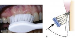 How to Brush your Teeth Properly