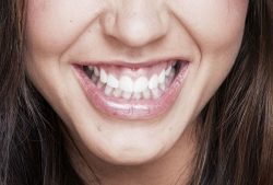 Laser Dentistry In Houston TX | Laser Gum Surgery