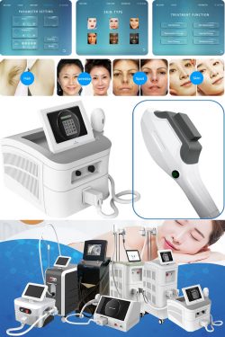 The efficacy of IPL intense pulsed light machine