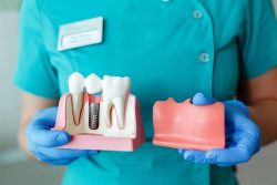 Best Dental Implant Specialist | Best dental clinic Near Me