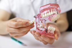 Pediatric Dentist in Miami, FL | Miami Children’s Smiles