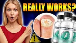 Kerassentials Reviews | Is It Scam or Legit | How To Buy?