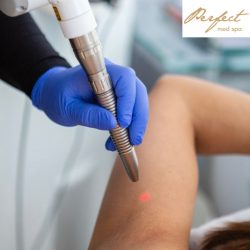 Laser Hair Removal Treatment, NY