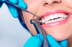 Childrens Dentist San Jose | Avanti Dental Group