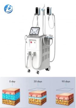 Cryolipolysis