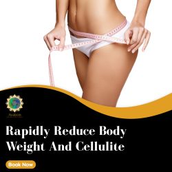 Cellulite Reduction Treatment in Houston – Avalon Body Sculpting