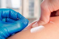 Are ims/dry needling effective?