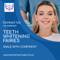 Teeth Whitening Fairies