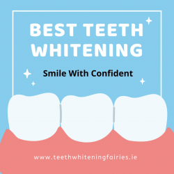 professional and experienced dental whitening in Dublin