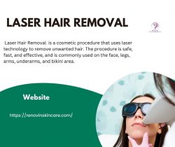 Laser Hair Removal