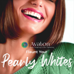 Teeth Whitening in Houston, TX – Avalon Body Sculpting