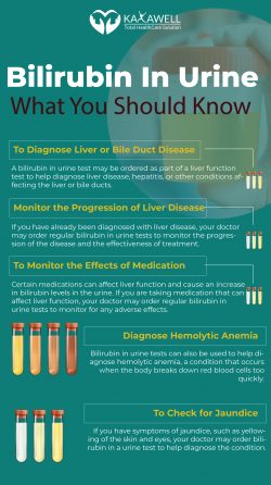 What Happens During Biliburin In Urine Tests?