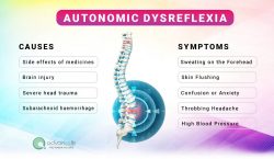 Autonomic Dysreflexia In Spinal Cord Injury