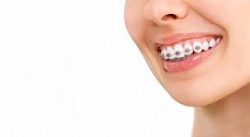 Best Orthodontist Specialists