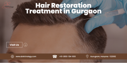 Hair Restoration Treatment in Gurgaon