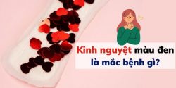 Kinh nguyệt màu đen là mắc bệnh gì? Nguyên nhân tại sao?