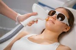 Laser Hair Removal Singapore