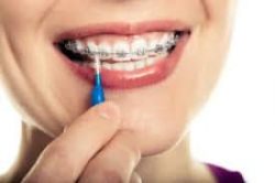 Best Expert Orthodontist in Miami