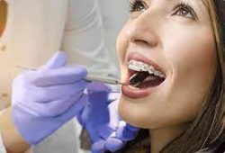 Best Orthodontist Specialists In Miami | Florida