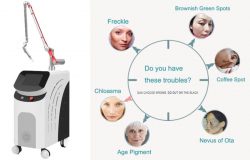 Effectiveness of the picosecond laser and the precautions after treatment