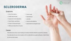 Scleroderma Symptoms, Types, and Available Treatment