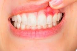 Houston Emergency Dentist For Urgent Dental Care