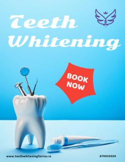 Teeth Whitening Fairies