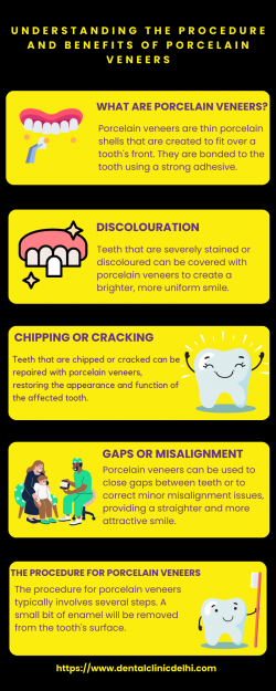 Understanding the Procedure and Benefits of Porcelain Veneers