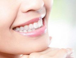 Best Dentist in Sirsi Road