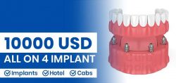 All on 4 dental implants cost