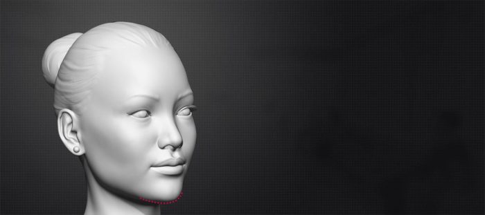 Chin Reduction Cost in India