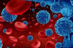 Hematologic Malignancies Market Report 2023-2028