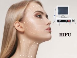 HIFU ultrasound face lifting treatment principles and safety