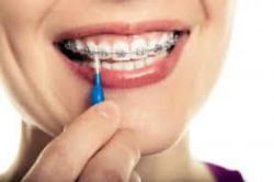 Best Orthodontics Specialists Of Florida