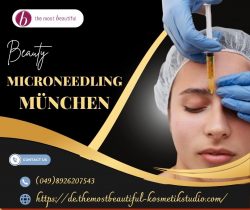 Microneedling München