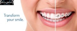 Best orthodontist in Delhi