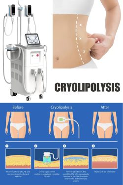 Do you know about cryolipolysis fat freezing slimming machine?