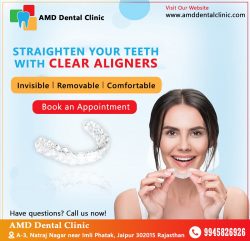 Clear Aligners