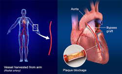 Best cardiology hospital in india – Medicturist.com