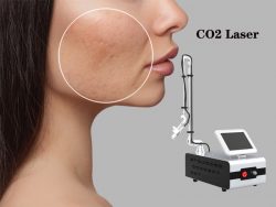 CO2 fractional laser facial treatment range