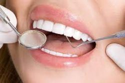 Best Dentist in Sirsi Road