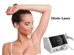 The best laser hair removal machine alexandrite