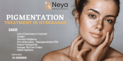 Why Your Hyperpigmentation Isn’t Going Away