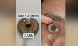 best artificial eye doctor near me