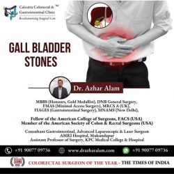 Advanced Laparoscopic Surgery for Gall bladder Stone