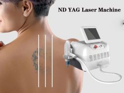 Q switched ND YAG laser tattoo removal machine for sale