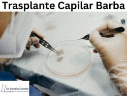 Transforma Tu Barba Con Los Servicios De Trasplante Capilar De Barba – Linzoain