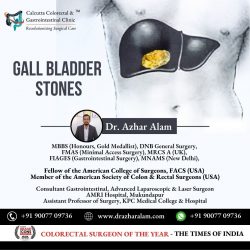 Advanced Laparoscopic Surgery for Gall bladder Stone