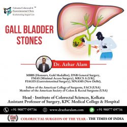 Advanced Laparoscopic Surgery for Gall bladder Stone