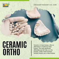 Ceramic ortho: An aesthetically pleasing orthodontic solution!